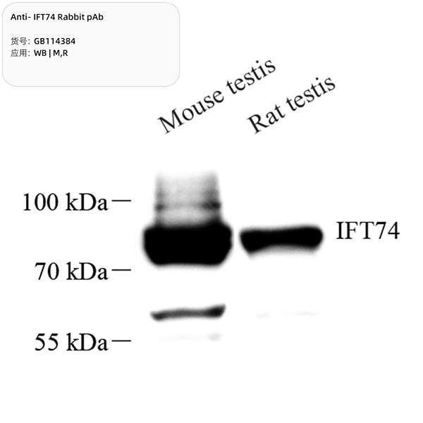 Антитела первичные, поликлональные, IFT74, 100 мкл