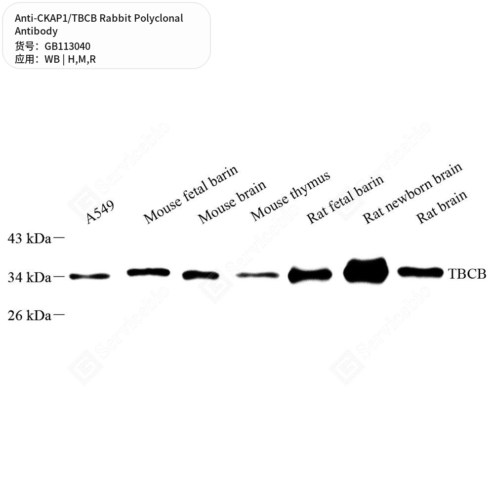 Антитела первичные, поликлональные кролика к CKAP1/TBCB крысы, мыши, человека, 100 мкл