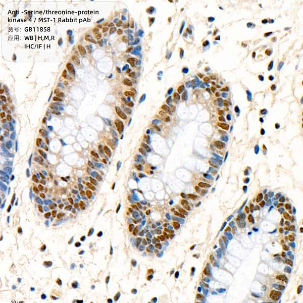 Антитела первичные, поликлональные, Serine/threonine-protein kinase 4/MST-1, 100 мкл