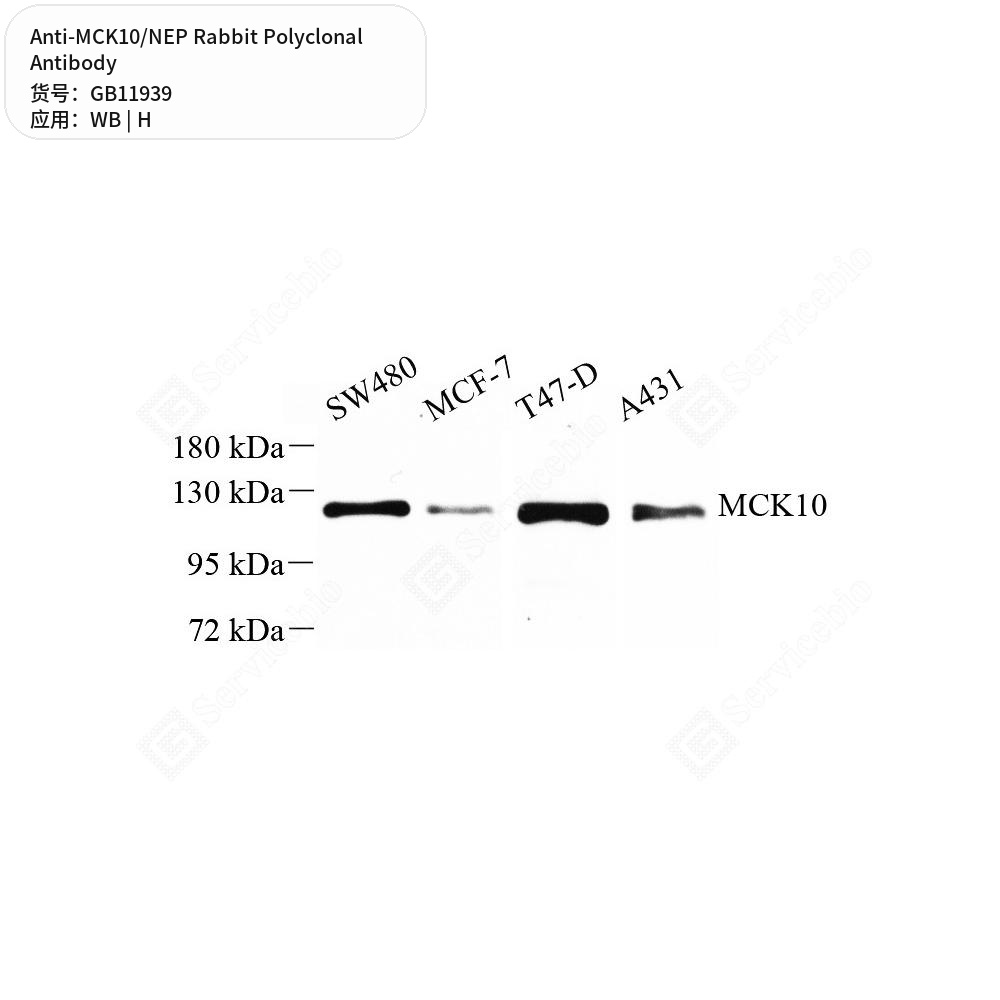 Антитела первичные, поликлональные кролика к MCK10/NEP человека, 50 мкл