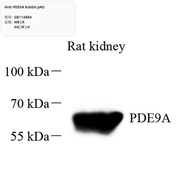 Антитела первичные, поликлональные, PDE9A, 100 мкл
