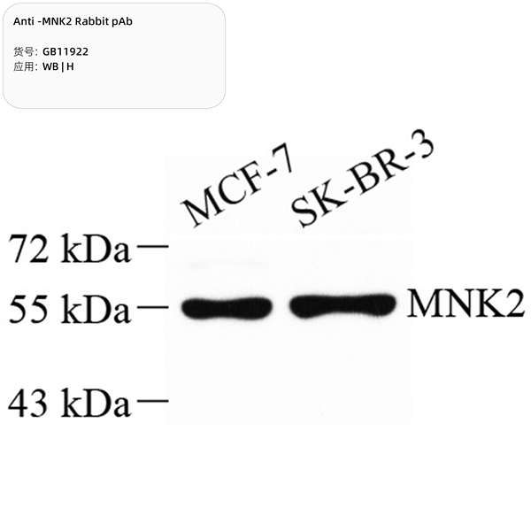 Антитела первичные, поликлональные, MNK2, 100 мкл