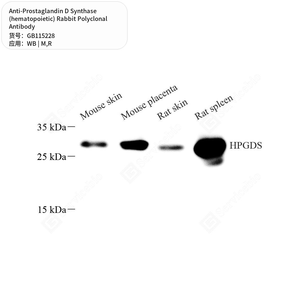 Антитела первичные, поликл. кролика к Prostaglandin D Synthase (hematopoietic) крысы, мыши, 50 мкл
