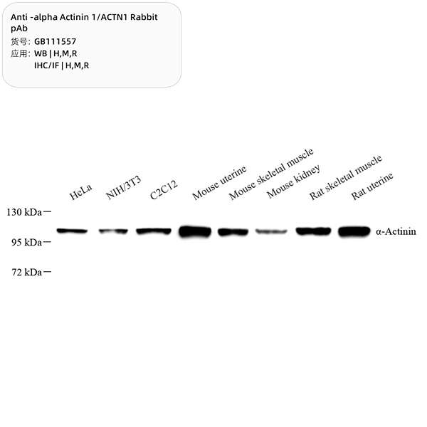 Антитела первичные, поликлональные, alpha Actinin 1/ACTN1, 100 мкл