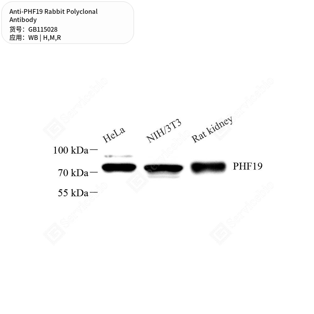 Антитела первичные, поликлональные кролика к PHF19 крысы, мыши, человека, 50 мкл