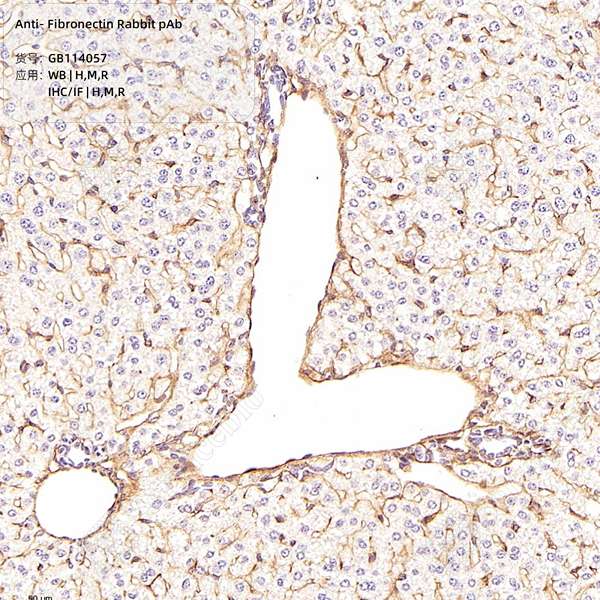 Антитела первичные, поликлональные, Fibronectin, 100 мкл