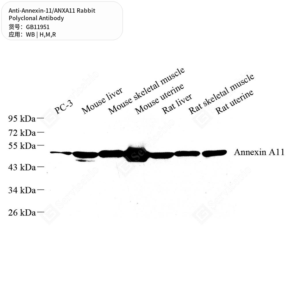 Антитела первичные, поликлональные кролика к Annexin-11/ANXA11 крысы, мыши, человека, 50 мкл