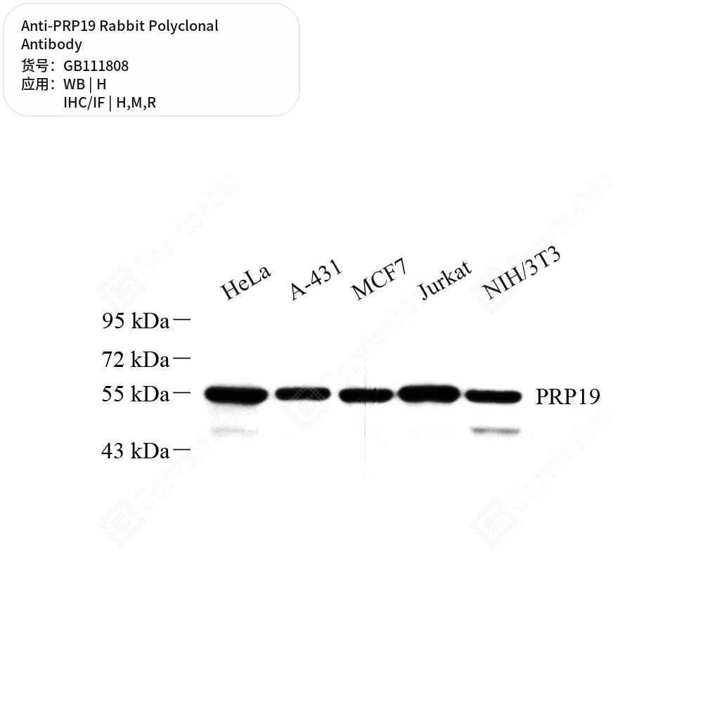 Антитела первичные, поликлональные кролика к PRP19 крысы, мыши, человека, 100 мкл