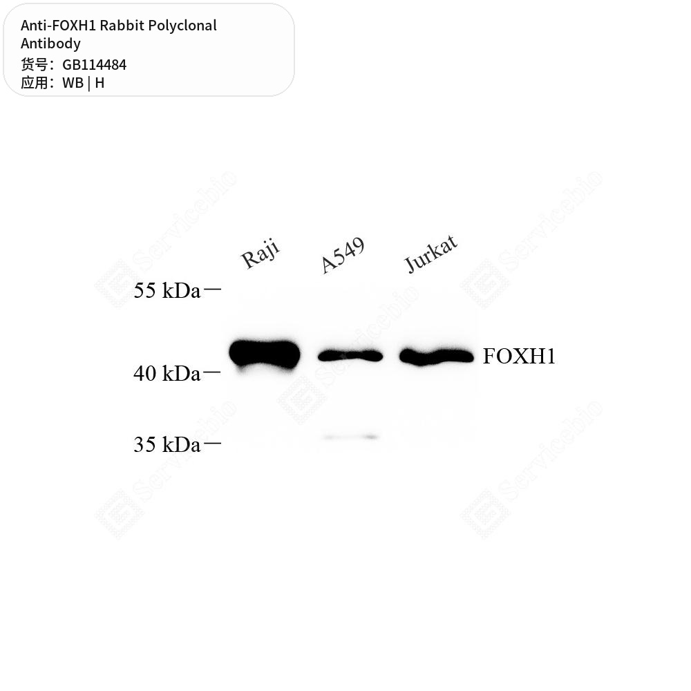 Антитела первичные, поликлональные кролика к FOXH1 человека, 100 мкл