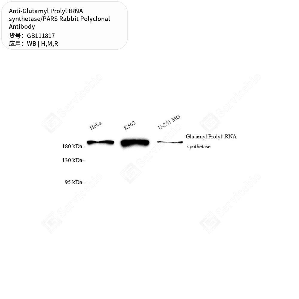 Антитела первичные, полик. крол. к Glutamyl Prolyl tRNA synthetase/PARS крысы, мыши, чел., 100 мкл