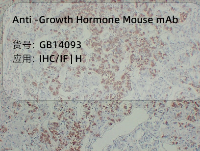 Антитела первичные, моноклональные мыши к Growth Hormone человека, 50 мкл