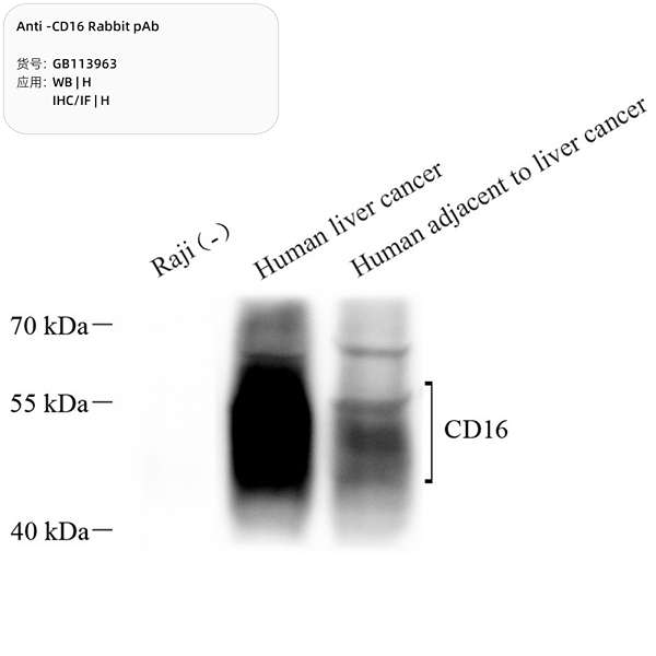 Антитела первичные, поликлональные, CD16, 100 мкл