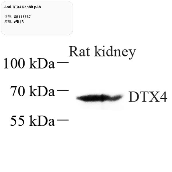 Антитела первичные, поликлональные, DTX4, 100 мкл