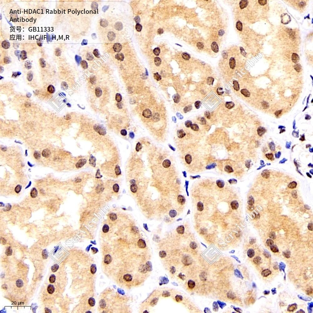 Антитела первичные, поликлональные кролика к HDAC1 крысы, мыши, человека, 100 мкл