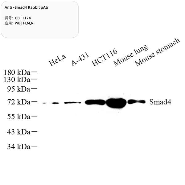 Антитела первичные, поликлональные, Smad4, 100 мкл