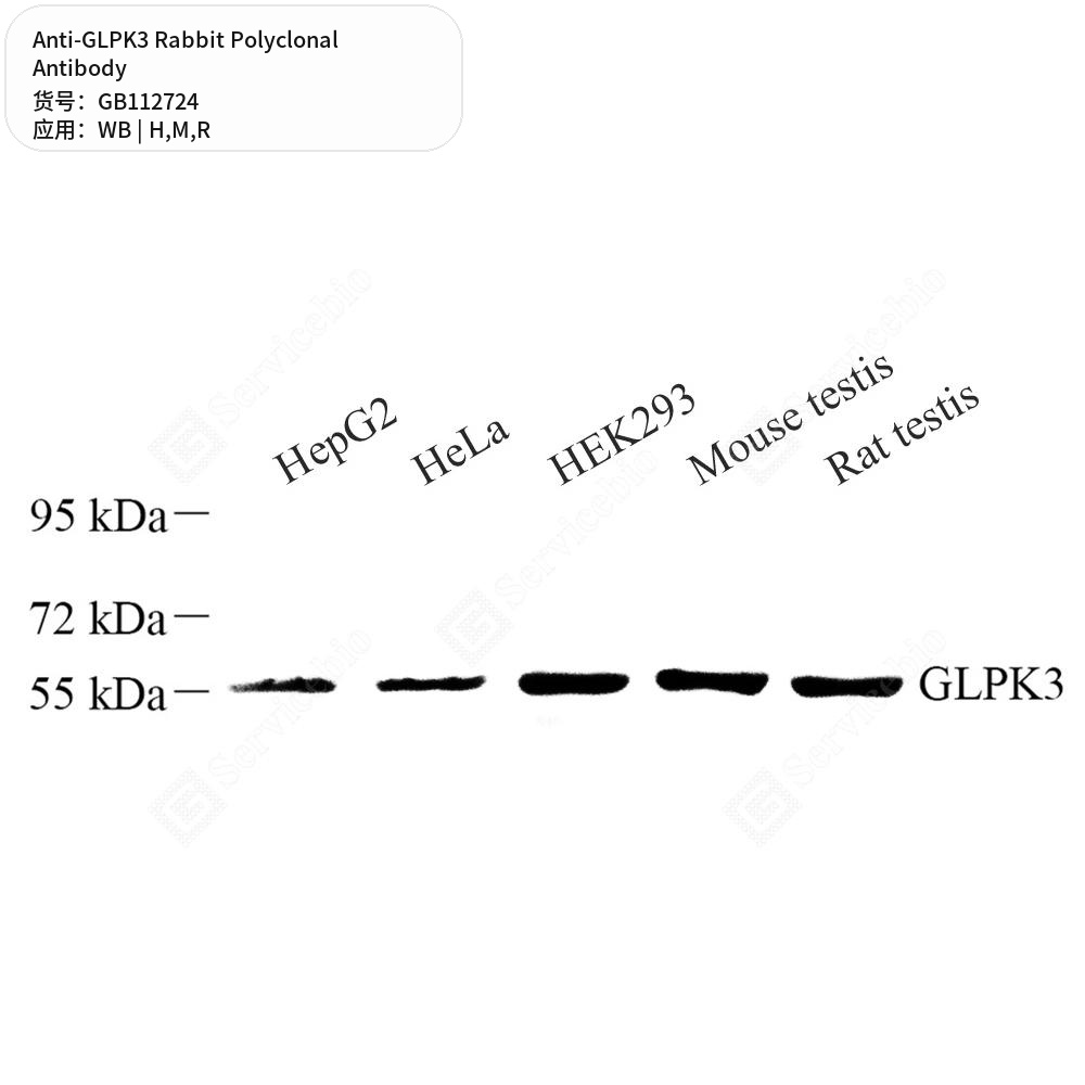 Антитела первичные, поликлональные кролика к GLPK3 крысы, мыши, человека, 50 мкл