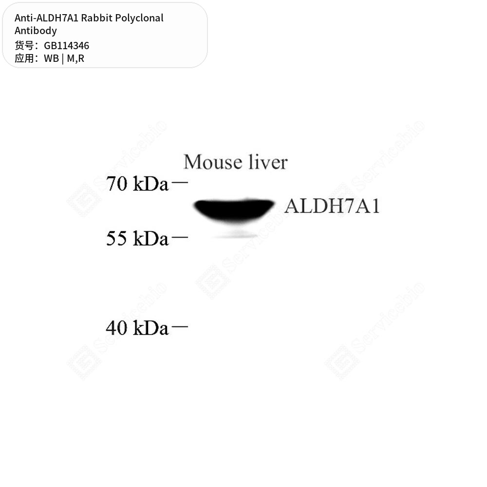 Антитела первичные, поликлональные кролика к ALDH7A1 крысы, мыши, 50 мкл