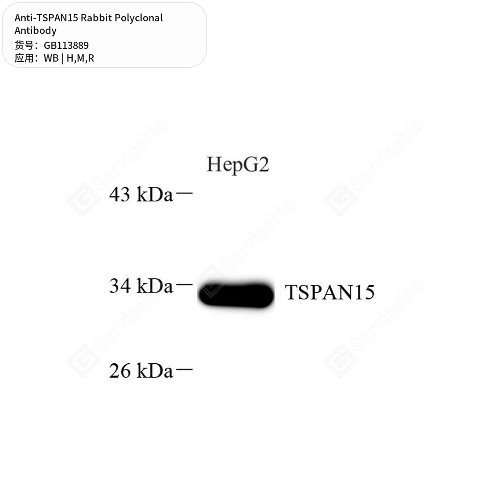 Антитела первичные, поликлональные кролика к TSPAN15 крысы, мыши, человека, 100 мкл