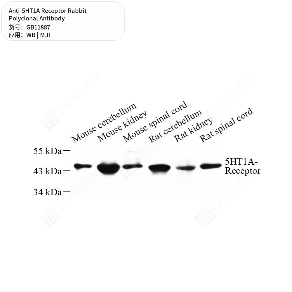 Антитела первичные, поликлональные кролика к 5HT1A Receptor крысы, мыши, 50 мкл