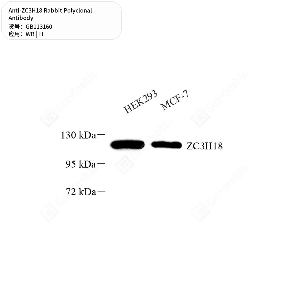 Антитела первичные, поликлональные кролика к ZC3H18 человека, 100 мкл