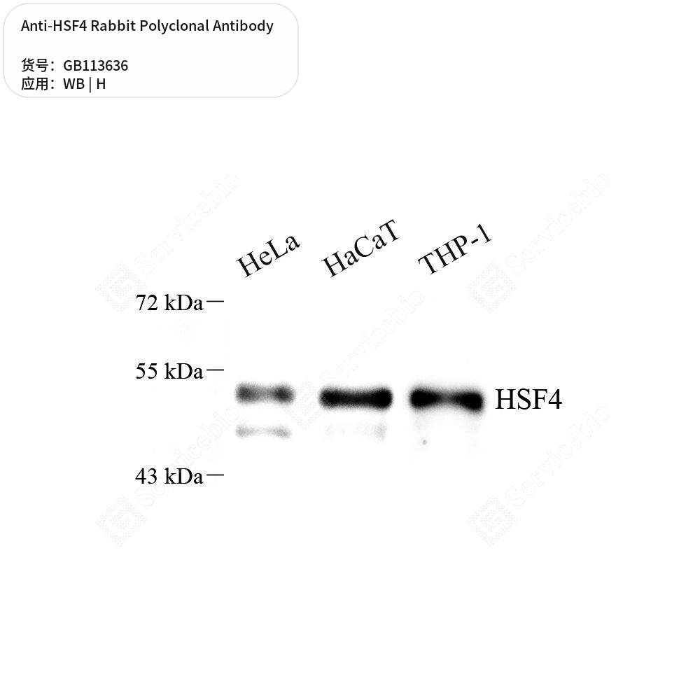 Антитела первичные, поликлональные кролика к HSF4 человека, 100 мкл