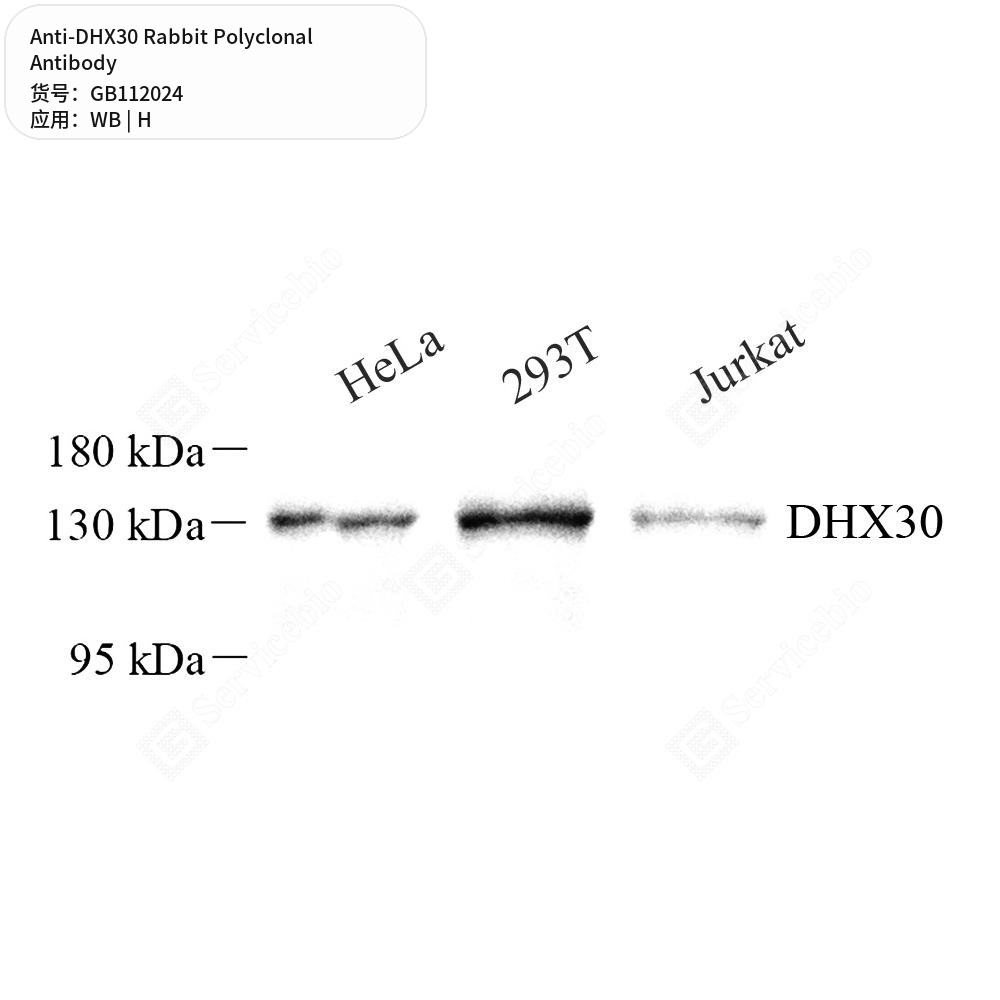 Антитела первичные, поликлональные кролика к DHX30 человека, 100 мкл
