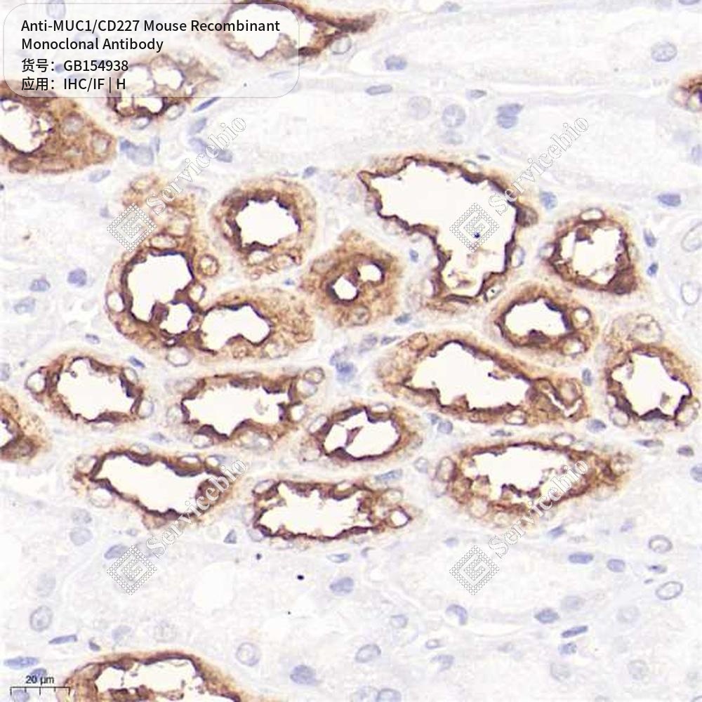 Антитела первичные, моноклональные мыши к MUC1/CD227 человека, 100 мкл