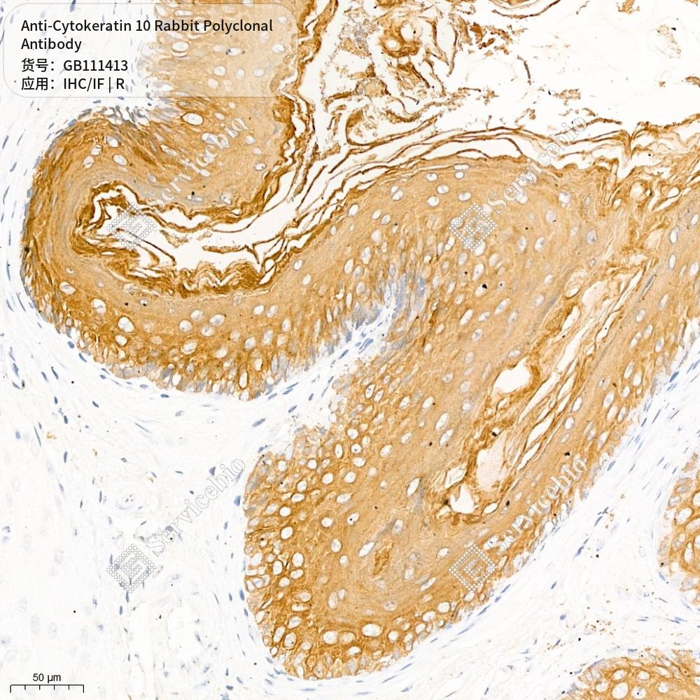 Антитела первичные, поликлональные кролика к Cytokeratin 10 крысы, 100 мкл