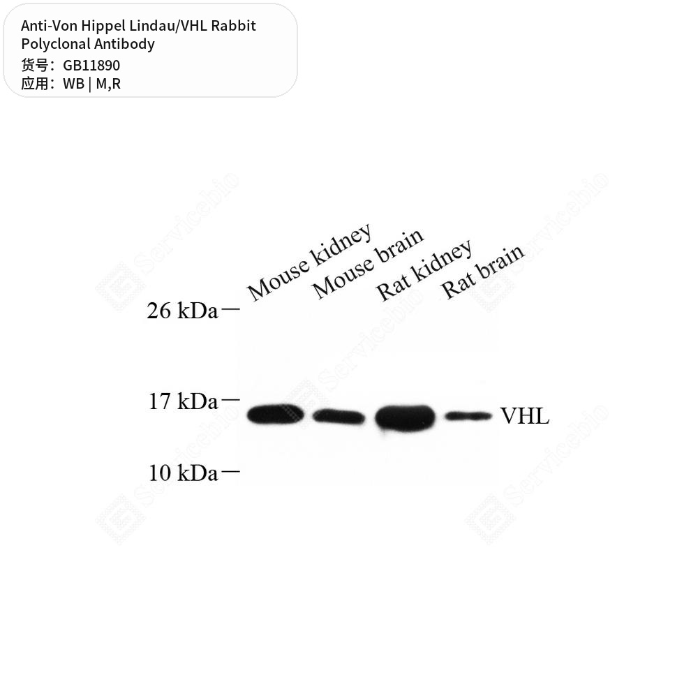Антитела первичные, поликлональные кролика к Von Hippel Lindau/VHL крысы, мыши, 50 мкл