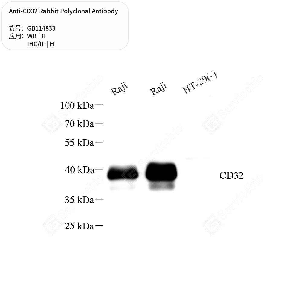 Антитела первичные, поликлональные кролика к CD32 человека, 100 мкл