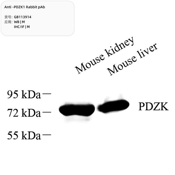Антитела первичные, поликлональные, PDZK1, 100 мкл