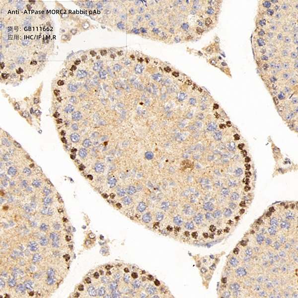 Антитела первичные, поликлональные, ATPase MORC2, 100 мкл