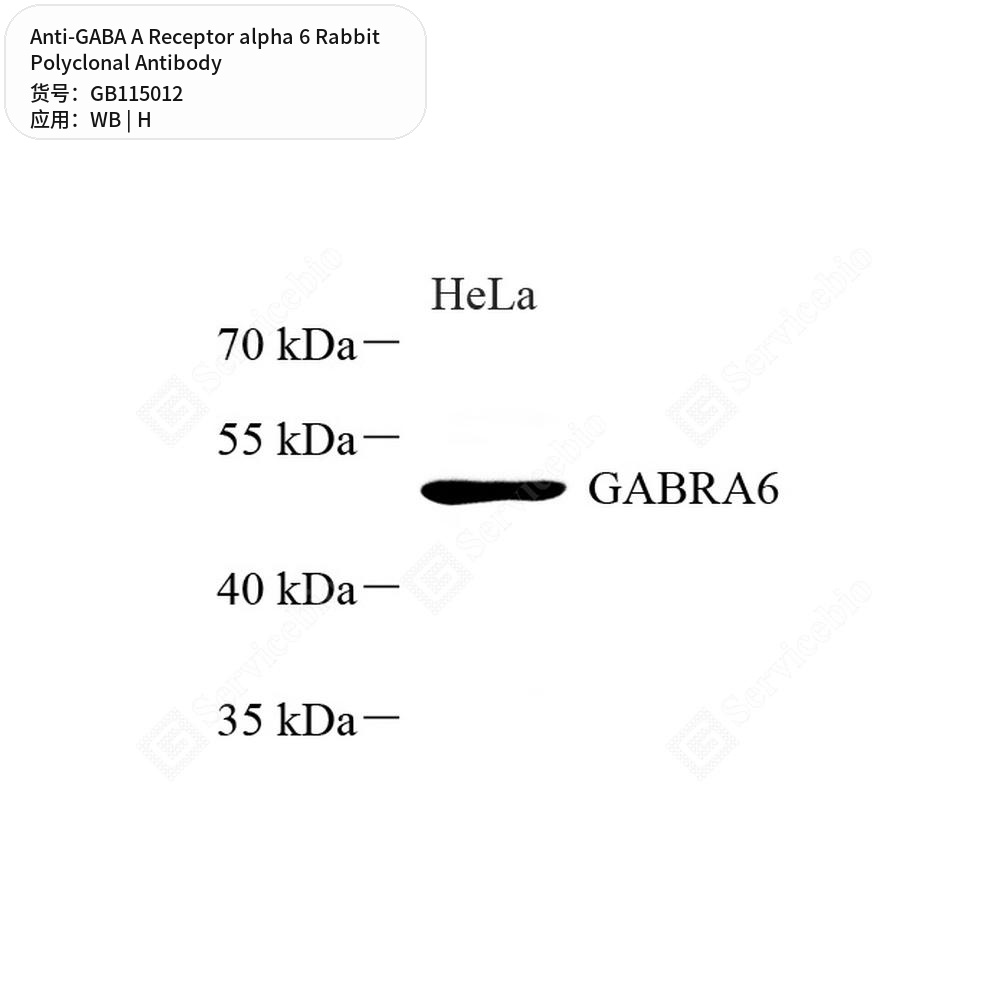 Антитела первичные, поликлональные кролика к GABA A Receptor alpha 6 человека, 50 мкл