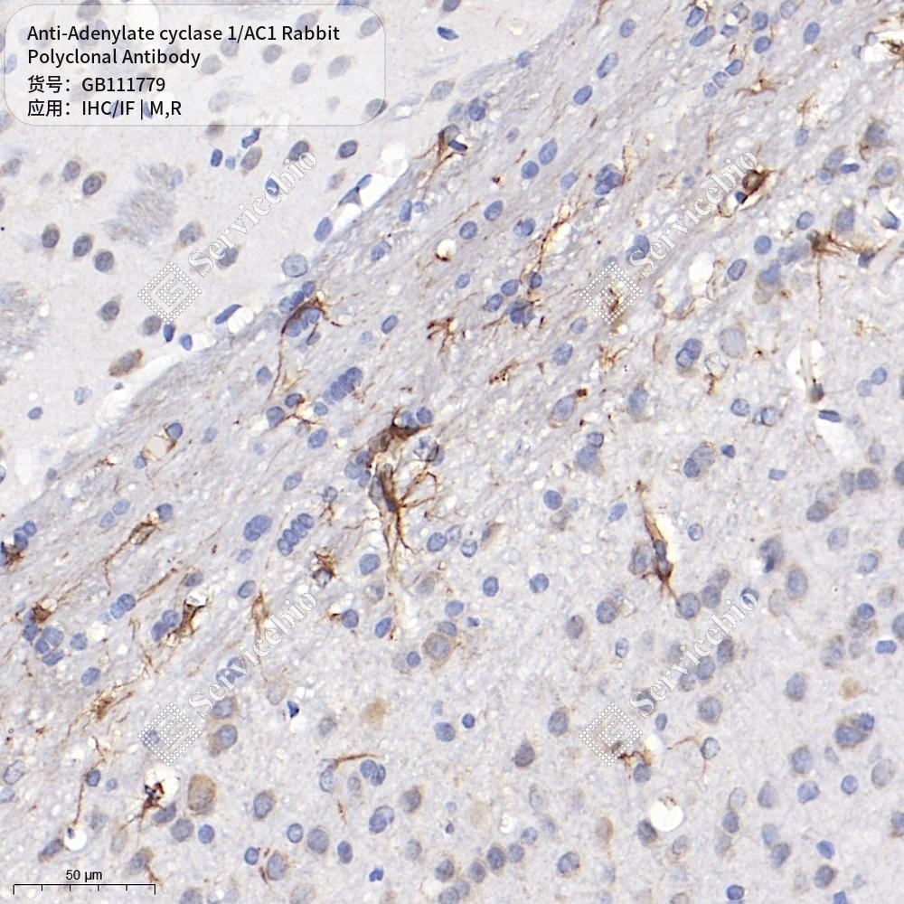 Антитела первичные, поликлональные кролика к Adenylate cyclase 1/AC1 крысы, мыши, 100 мкл