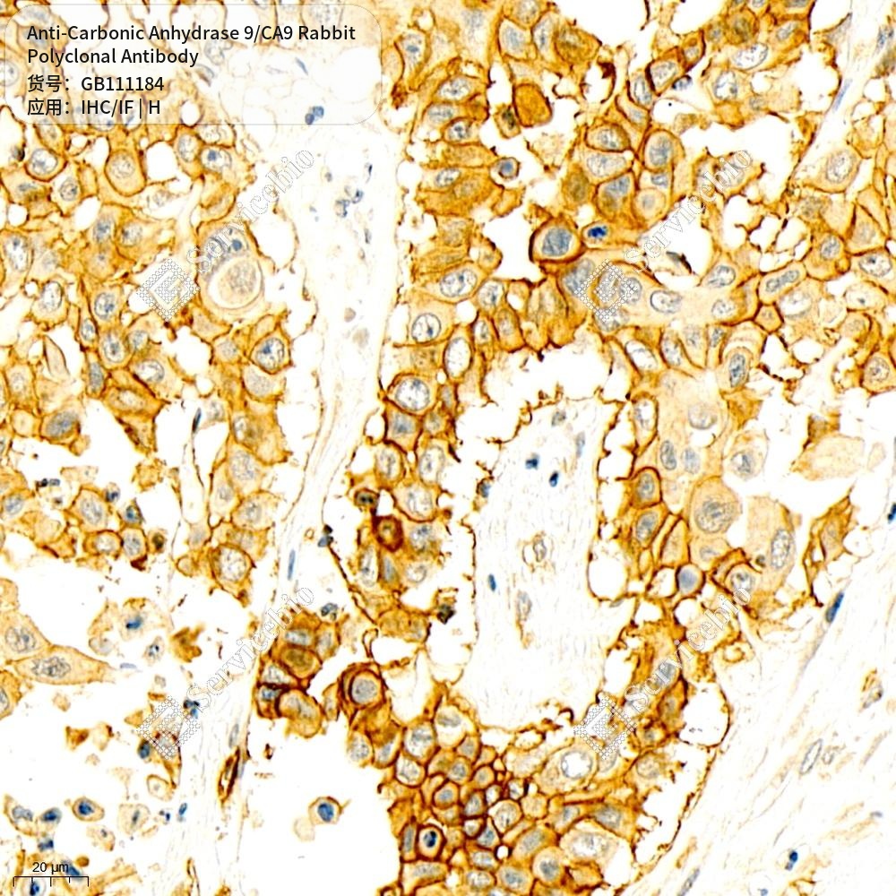 Антитела первичные, поликлональные кролика к Carbonic Anhydrase 9/CA9 человека, 100 мкл
