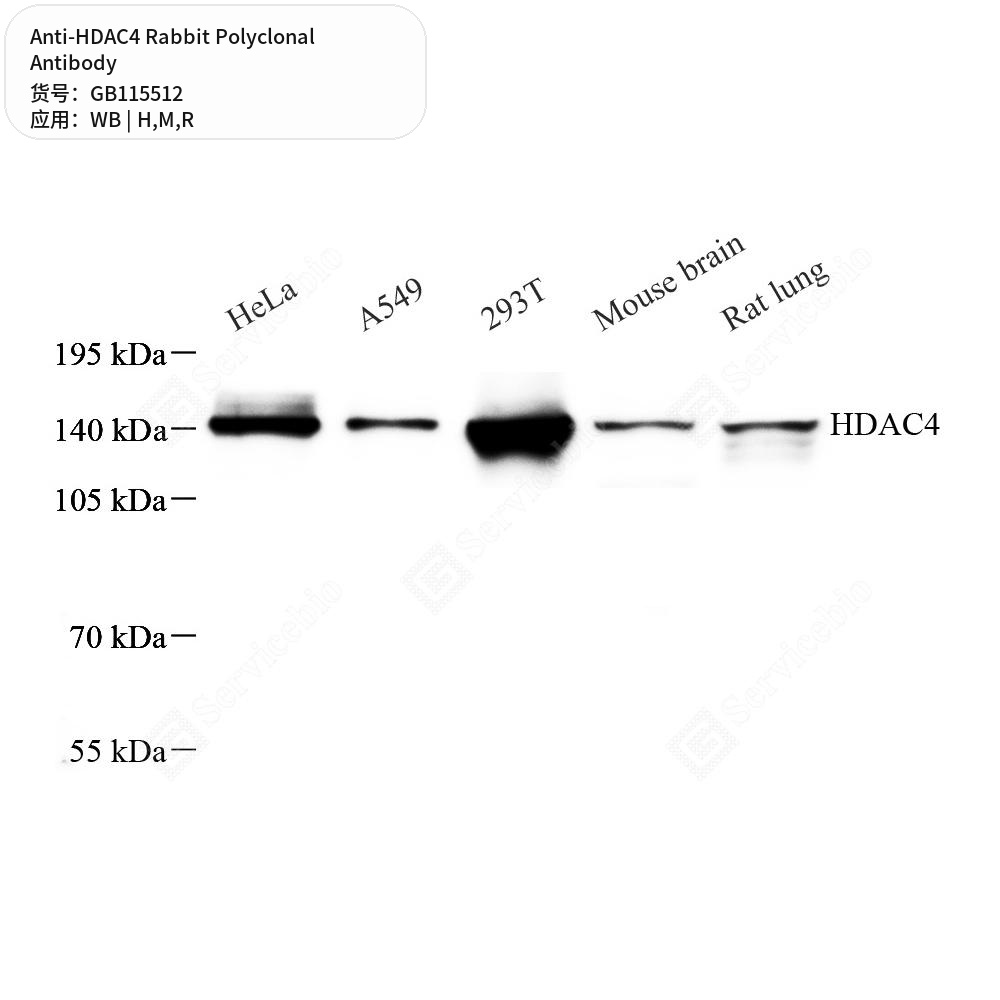 Антитела первичные, поликлональные кролика к HDAC4 крысы, мыши, человека, 50 мкл