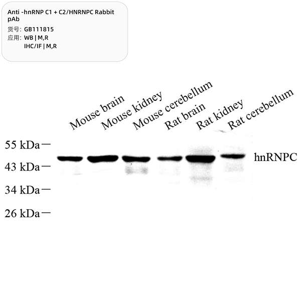 Антитела первичные, поликлональные, hnRNP C1 + C2/HNRNPC, 100 мкл