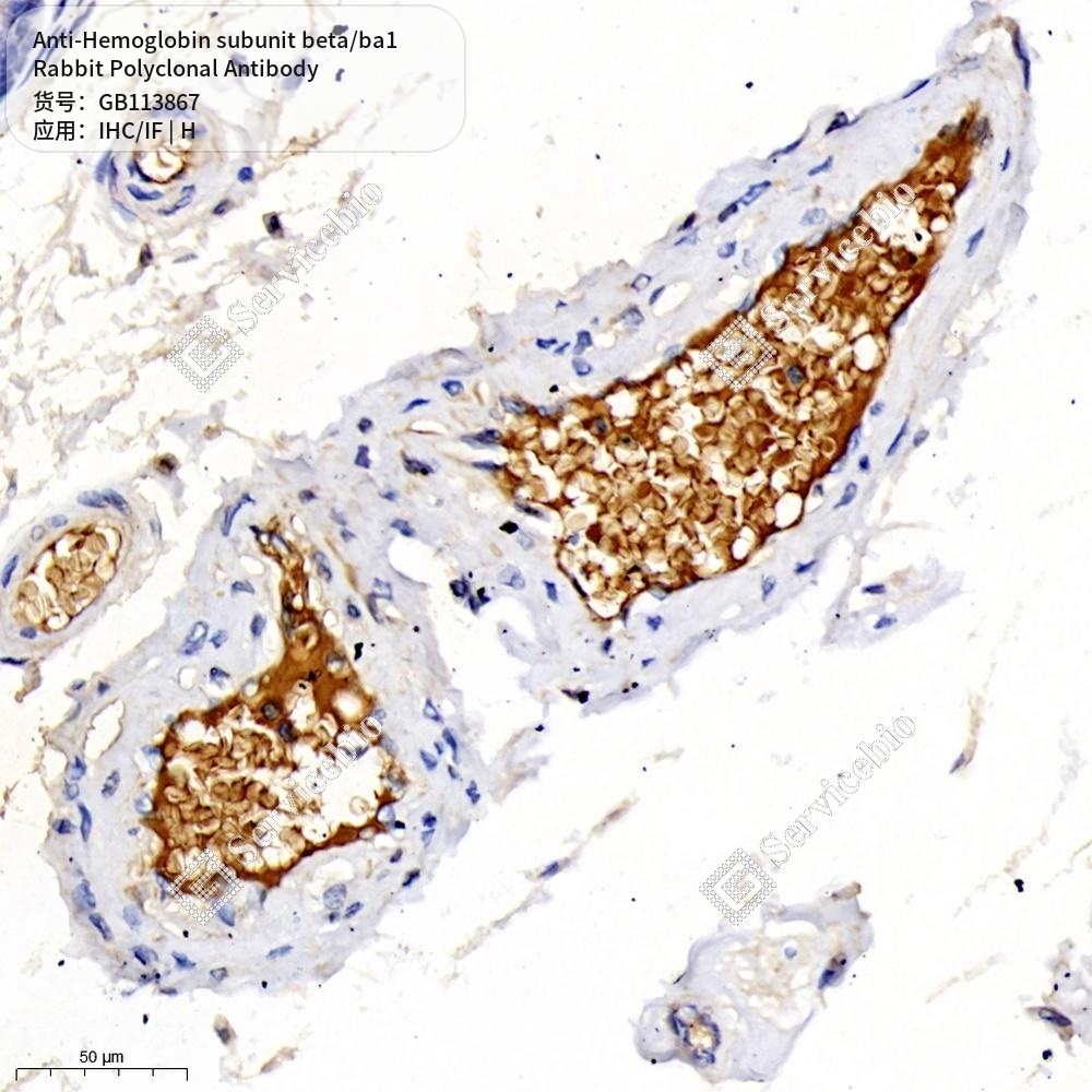 Антитела первичные, поликлональные кролика к Hemoglobin subunit beta/ba1 человека, 100 мкл