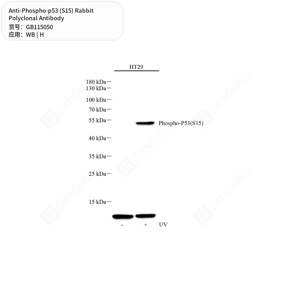 Антитела первичные, поликлональные кролика к Phospho-p53 (S15) человека, 100 мкл