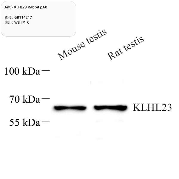 Антитела первичные, поликлональные, KLHL23, 100 мкл