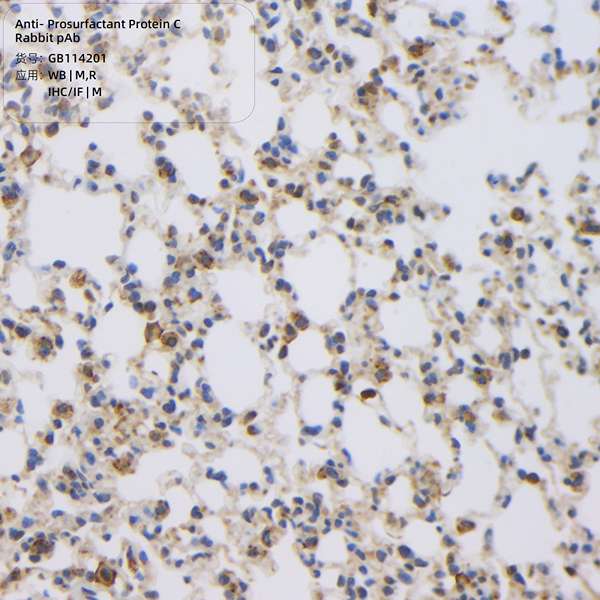 Антитела первичные, поликлональные, Prosurfactant Protein C, 100 мкл