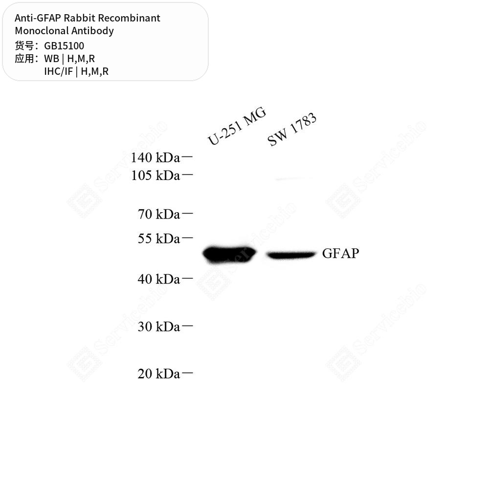 Антитела первичные, моноклональные кролика к GFAP крысы, мыши, человека, 50 мкл