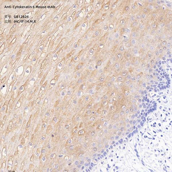 Антитела первичные, моноклональные, Cytokeratin 6, 100 мкл