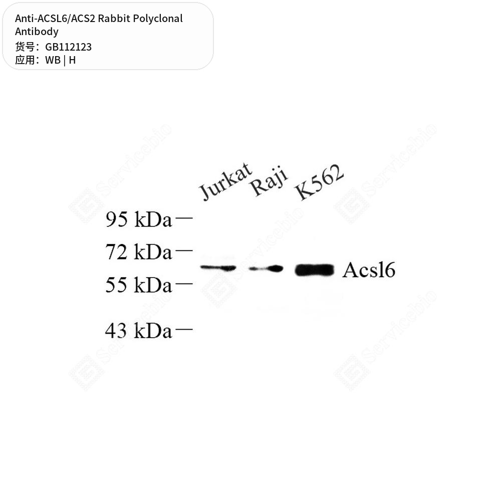 Антитела первичные, поликлональные кролика к ACSL6/ACS2 человека, 100 мкл