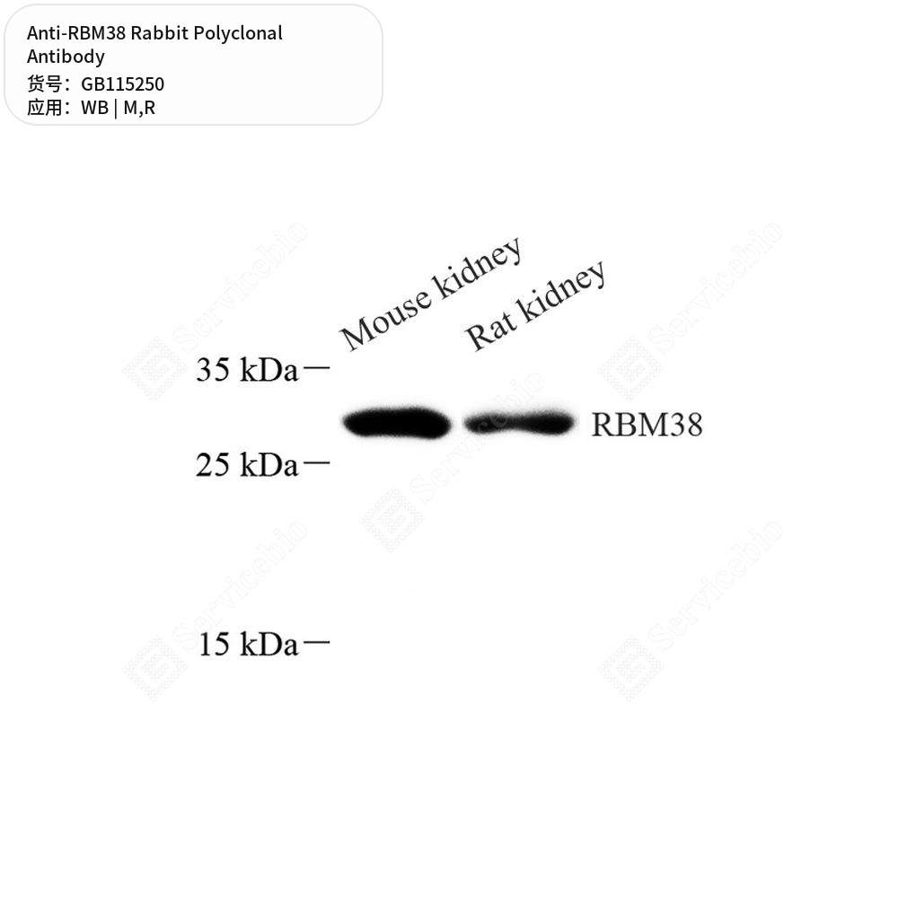 Антитела первичные, поликлональные кролика к RBM38 крысы, мыши, 100 мкл