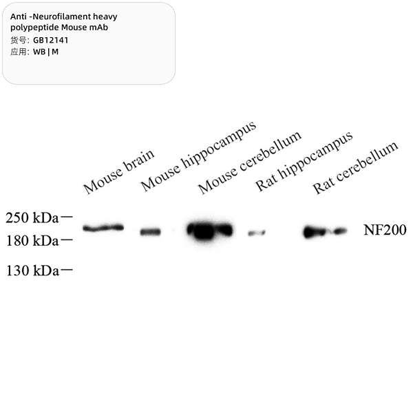 Антитела первичные, моноклональные, Neurofilament heavy polypeptide, 100 мкл