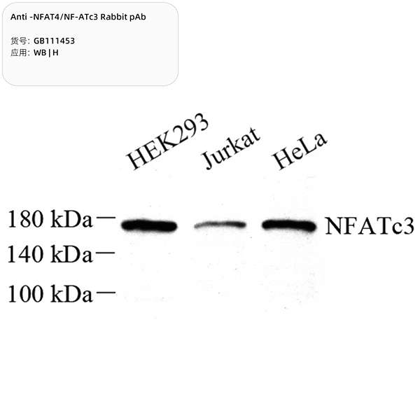 Антитела первичные, поликлональные, NFAT4/NF-ATc3, 100 мкл