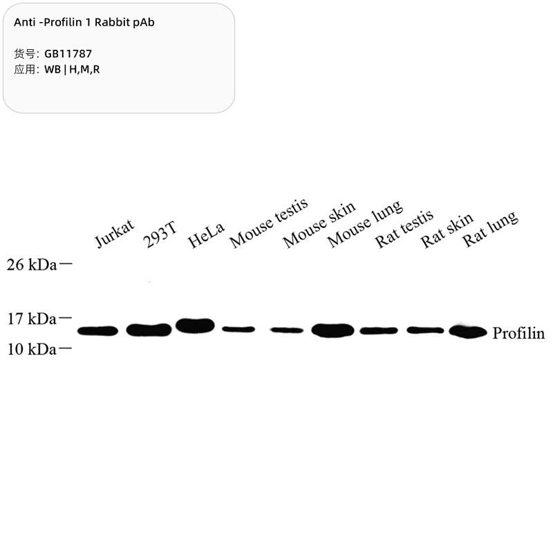 Антитела первичные, поликлональные, Profilin 1, 100 мкл