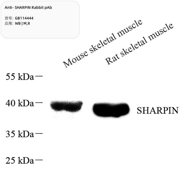 Антитела первичные, поликлональные, SHARPIN, 100 мкл