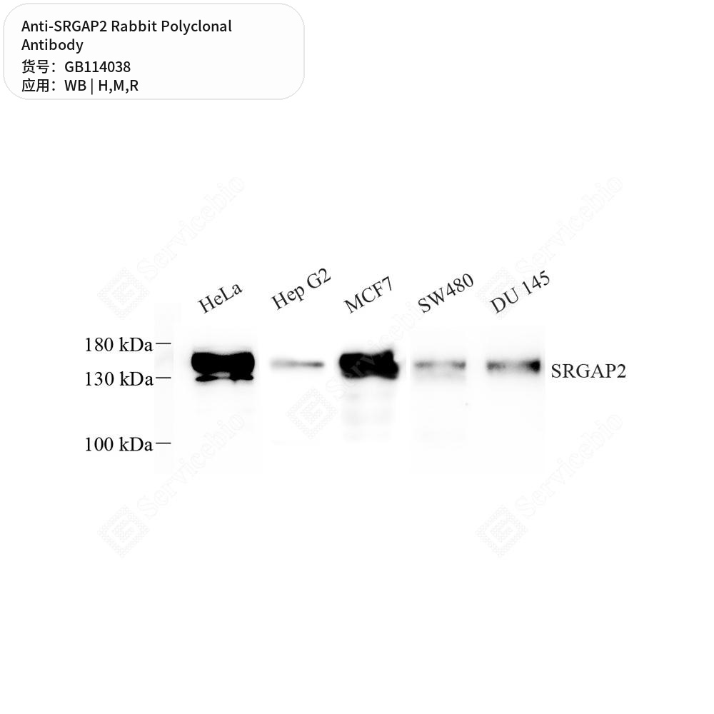 Антитела первичные, поликлональные кролика к SRGAP2 крысы, мыши, человека, 50 мкл